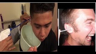 EPIC EAR WAX REMOVAL  Elephant Ear Washer Bottle System by Doctor Easy [upl. by Truda200]