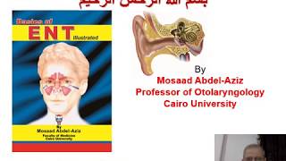 Ear 5 Mosaad AbdelAziz Complications of Suppurative Otitis Media [upl. by Sverre721]