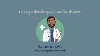 Chirurgie dermatologique  exérèse dune cicatrice chéloïde [upl. by Acirat271]