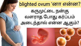 blighted ovum pregnancy in tamil  anembryonic pregnancy tamil  positive pregnancy test but no baby [upl. by Eidnil]