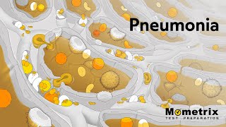 Pneumonia  NCLEX Review [upl. by Oicor]