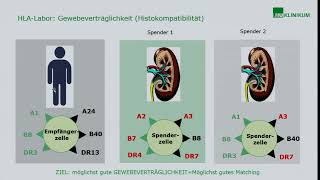 Spendennierenverteilung  Warum warte ich so lange [upl. by Bridgette]