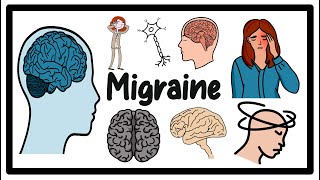 Migraine Headache Causes Symptoms amp Treatment Guide [upl. by Furey730]