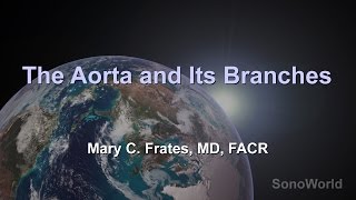 quotThe Aorta and its Branchesquot Ultrasound SonoWorld Lecture [upl. by Imoen]