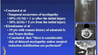 Spine Odontoid Fractures Overview and Surgical Treatment [upl. by Allak59]