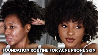 FLAWLESS FOUNDATION ROUTINE FOR ACNE PRONETEXTURED SKIN  KENSTHETIC [upl. by Maxa]