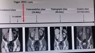 CT SCAN INTERVIEW WITH NCCT KUB CECT KUB UROGRAPHY [upl. by Anihtyc939]