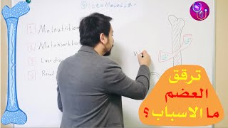 اسباب ضعف العضام Osteomalacia [upl. by Nohsal]