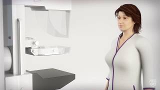 Mammogram for Breast Cancer  What to Expect [upl. by Barnaba232]