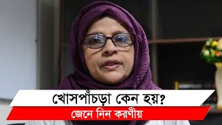 খোসপাঁচড়া বা স্ক্যাবিস রোগ কেন হয় এ রোগের চিকিৎসা কী জেনে নিন করণীয় II Dr Rebeka Sultana [upl. by Solomon]