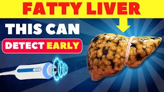 The Best 3 Tests to Detect Fatty Liver Early  Fatty Liver fattyliver health [upl. by Emmye493]