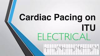 Transcutaneous and Transvenous Cardiac Pacing on Intensive Care [upl. by Auqenet]