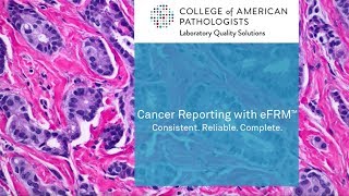 Cancer Reporting with eFRM [upl. by Burck]