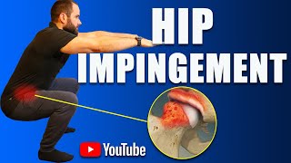 Hip Impingement Pain FAI Best Exercises Rehab amp Strengthening How to Avoid Surgery [upl. by Inad]