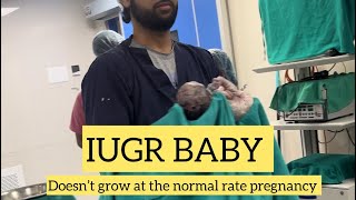 IUGR BABY doesn’t grow at the normal ate pregnancy  ankur maitrika hospital 🏥♥️ [upl. by Htirehc]