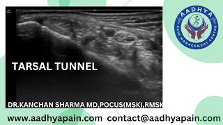 Ultrasound of the Tarsal Tunnel [upl. by Mikahs18]