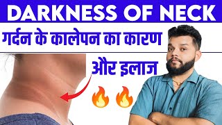 गर्दन और घुटने के कालापन से छुटकारा 🔥 Darkness Of Neck Treatment  Acanthosis Nigricans In Hindi [upl. by Yenahs539]