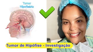 Tumor Cerebral  Tumores de Hipófise  Investigação Pré Operatória [upl. by Ahtnams]