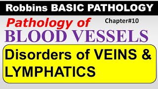 Ch10  Disorders of Veins amp Lymphatics  Blood Vessel Pathology  Robbins Lectures [upl. by Attayek534]