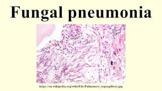 Fungal pneumonia [upl. by Acsot293]