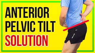 How to Fix Anterior Pelvic Tilt 4 KEY EXERCISES [upl. by Constantina]