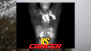 Beat the Cancer  Recover and Comeback [upl. by Nelyk]