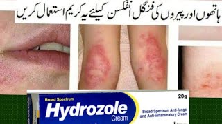 Hydrozole Cream Uses  Tee fatima [upl. by Imoyn]