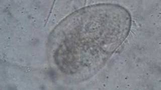 Ciliate sweeping up bacteria [upl. by Nayrbo]