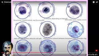 Diagnostic Parasitology Entamoeba histolyticaCourse [upl. by Gerhard]