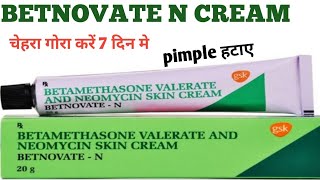 Betnovate N Cream  Betamethasone Valerate And Neomycin Skin Cream Review [upl. by Maltzman]