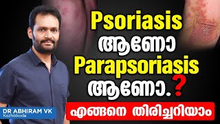 Psoriasis ആണോ Parapsoriasis ആണോഎങ്ങനെ തിരിച്ചറിയാം  Psoriasis Malayalam Treatment  Dr Ahiram VK [upl. by Allekram]