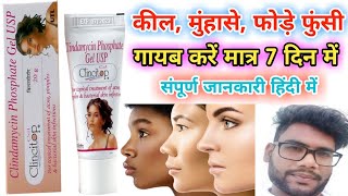 Clincitop gel uses and side effects  कील मुंहासे फोड़े फुन्शी की सबसे अच्छी क्रीम  Hindi review [upl. by Magnus351]