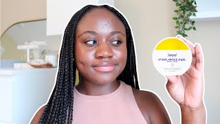 SUPERGOOP PLAY EVERYDAY LOTION SPF 50  SUNSCREEN REVIEW ON OILY ACNE PRONE SKIN [upl. by Trixie]