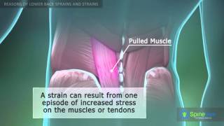 Lower Back Sprain and Strain Reasons [upl. by Nwahsd]