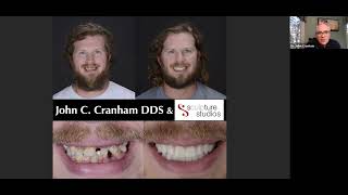 Webinar Occlusal Excellence in a Digital World with Dr John Cranham [upl. by Fortunna]