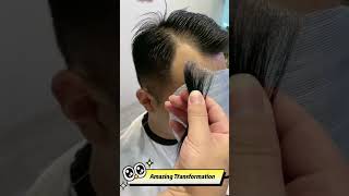 Perfect Solution to Hair Loss amp Thinning Hair  Hair Patch amp Hair Replacement  No Hair Transplant [upl. by Reitman]