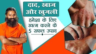 दाद खाज खुजली हमेशा के लिए खत्म करने के 5 सफल उपाय  Swami Ramdev [upl. by Htrahddis737]