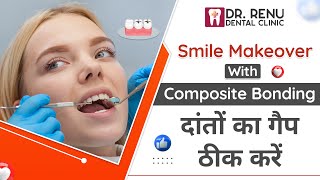 Unleash Your Perfect Smile with Composite Bonding Renu Dental Clinic in Jaipur  Best Dentist [upl. by Hole]