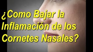 5 👀TRATAMIENTOS NATURALES para los 👃CORNETES de la NARIZ  Al 👉FINAL QUEDARAS 😲SORPRENDIDO [upl. by Lamhaj149]