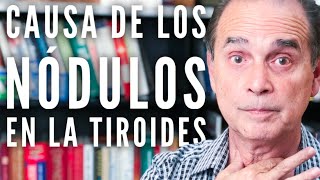 Episodio 1111 Causa De Los Nódulos En La Tiroides [upl. by Ancell]