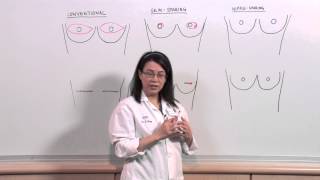 Types of Mastectomies What is nipplesparing reconstruction  Sonia Sugg MD [upl. by Anilet]