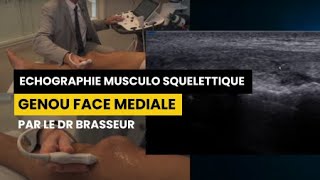 GENOU FACE MEDIALE  Echographie Musculo Squelettique par le Dr Brasseur [upl. by Radack]