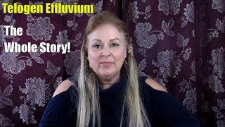 Telogen effluvium the whole story [upl. by Lucie]