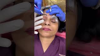 Eyebrow Microblading bestskincare bestskinclinic eyebrowtips eyebrowmicroblading [upl. by Humph976]