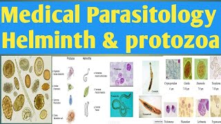 How to Identify Parasites Protozoa amp Helminths [upl. by Bulley]