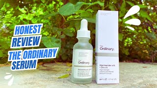 Honest review on the ordinary niacinamide 10 and zinc 1 serum  ordinary serum review [upl. by Ahsinrat]