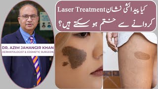 Laser Treatment in Lahore Pakistan  Hair Removal  Benefits  Risks  Cost  Cosmetique [upl. by Eillo]