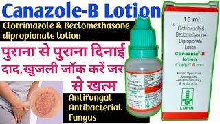 Canazole B Lotion Use Kaise Kare  खुजलाहट की समस्या अब करें जर से ख़त्म [upl. by Aitel]