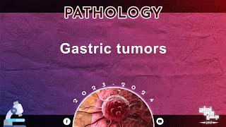 L3 Gastric Tumors pathology [upl. by Anoirtac]