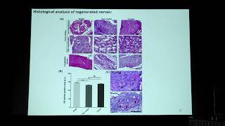 Oral Presentation Dr Akshat Joshi [upl. by Ines]